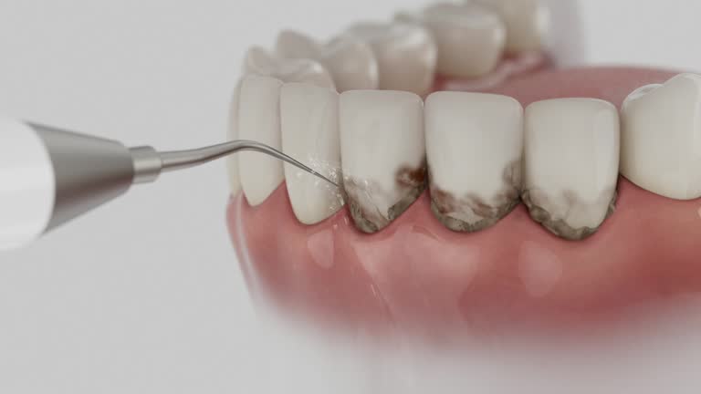 Reliable Teeth Cleaning And Checkup contractor in Edmunds County County, SD by Dentist Open Now